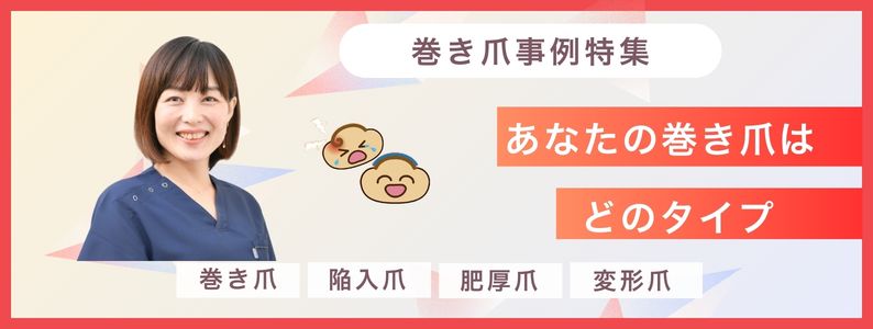 施術事例一覧へ